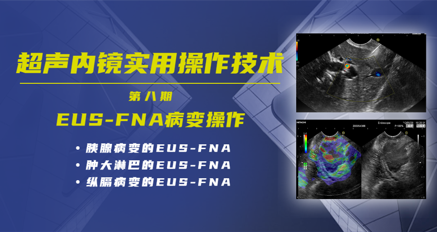 超声内镜实用操作技术