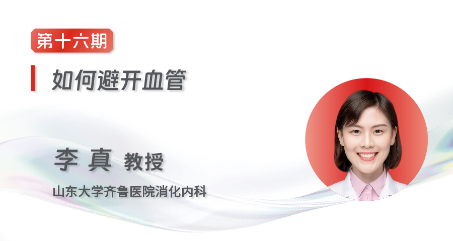 EUS-FNA/FNB齐鲁微课堂
